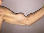 popeye-arm-1-6a27f902b9071ae7e29b73ed0543404a1685b9a9-s800-c85.jpg